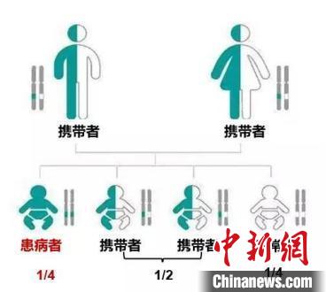 专家：罕见病并不“无计可施” 积极预防是关键