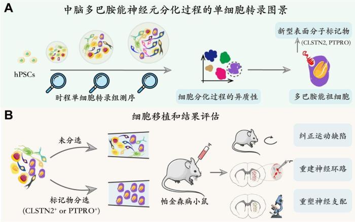 推动帕金森病治疗 新研究有助预测细胞替代疗法结果